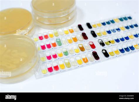 bacterial identification tests.